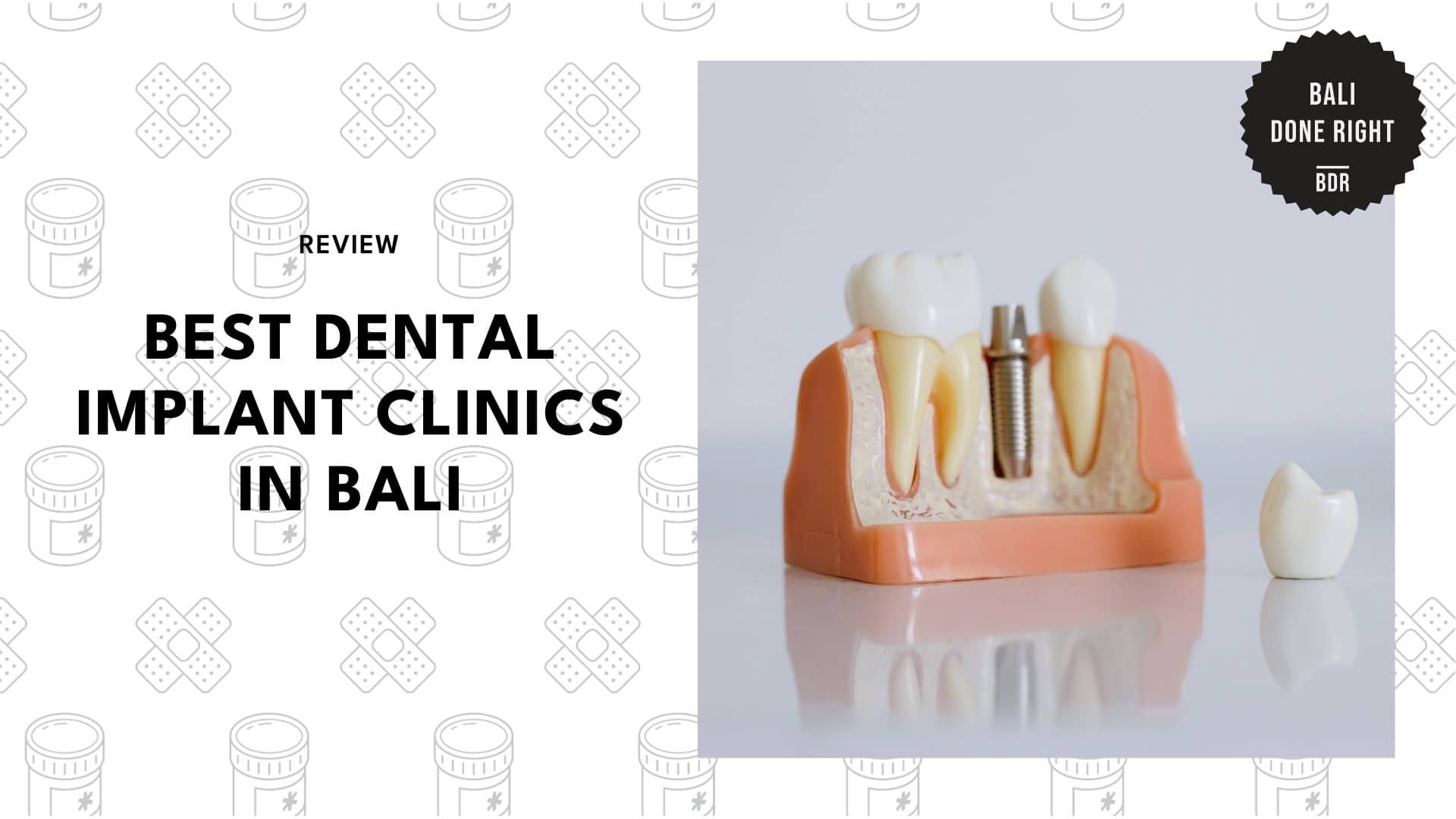 dental-implant-bali