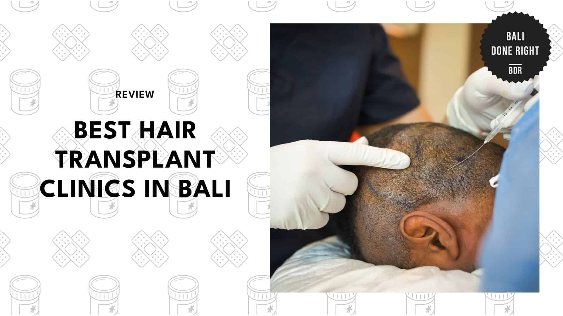 hair-transplant-bali